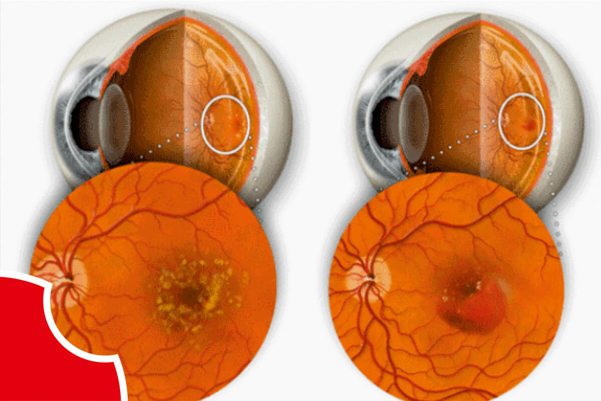 Medical retina checkup